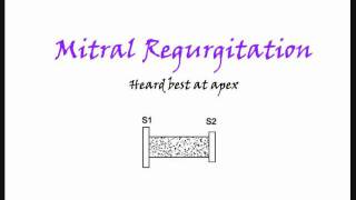 Mitral regurgitation also Tricupsid regurgitation heart murmur [upl. by Ewens654]