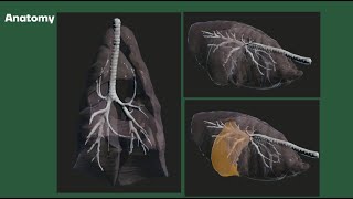 SOARMED Seminar  Thoracic Radiographic Interpretation การแปลผลภาพรังสีส่วนช่องอก 22 [upl. by Melisandra]