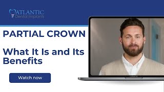 Partial Crown – What It Is and Its Benefits  Atlantic Dental Group [upl. by Gearhart]