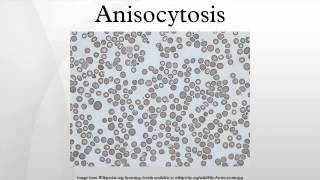 Anisocytosis [upl. by Aleta]