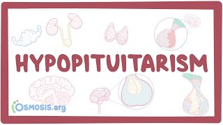 Hypopituitarism  causes symptoms diagnosis treatment pathology [upl. by Droffilc535]