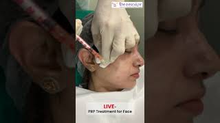 How Fillers and PlateletRich Plasma PRP Play Different Roles in Facial Rejuvenation [upl. by Nuoras]