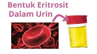 Sedimen urin eritrosit sel darah merah di mikroskop [upl. by Drawde]