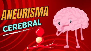 Aneurisma cerebral [upl. by Hnib]