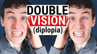 What Causes DOUBLE VISION Diplopia  5 Common Causes for Diplopia  Doctor Eye Health [upl. by Dore]