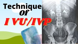 Technique of IVUIVP Ep36 Intravenous urogrampyelogram Procedure of IVUIVP test [upl. by Clarhe]