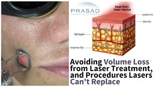 Avoiding Facial Volume Loss from Laser Radiofrequency Treatments and Procedures They Cant Replace [upl. by Airol]