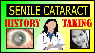 Senile Cataract Case Presentation History Taking amp Possible Viva Questions  Ophthalmology [upl. by Leila]