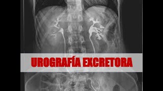 FLUORO DIA 5  UROGRAFIA EXCRETORA Y FISIOLOGIA DEL APARATO EXCRETOR [upl. by Swen]