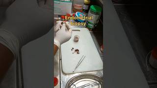 Endometrial product biopsy sample [upl. by Marybelle446]