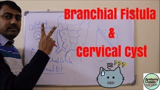 Embryological basis of Cervical cyst sinus and Branchial fistula [upl. by Ernestine]