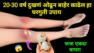 2030 वर्ष जुन दुखणं ओढून बाहेर काढेल हा घरगुती उपाय 😱home remedies  knee pain remedy  in marathi [upl. by Phia]