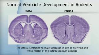 Developmental Neurotoxicity of Ultrafine Particles Parallels with Neurodevelopmental Disorders [upl. by Annoyik]