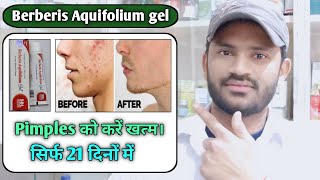 Berberis Aquifolium gel use dose benefits and Side effects full review in hindi [upl. by Znieh]