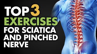 Top 3 Exercises for Sciatica and Pinched Nerve [upl. by Annaya730]