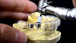 Dental implant surgical guide drilling protocol [upl. by Nylarak72]