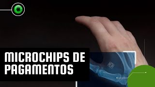 Microchips de pagamentos até que ponto os implantes são seguros [upl. by Karolina]