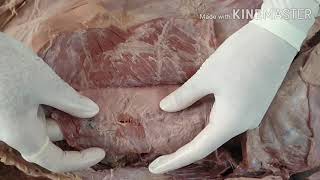 Dissection of Anterior Abdominal Wall by DrMeetu Agarwal [upl. by Ayanal919]