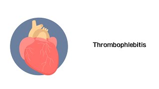 Thrombophlebitis  Erkrankungen der Gefäße und des Kreislauf [upl. by Wallace310]