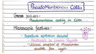 Infectious And Pseudomembranous Colitis [upl. by Aneladgam]