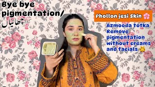 Melasma ka ilaj  Chehre ki Chaiyoon ka illaj  remove pigmentation [upl. by Ojimmas]