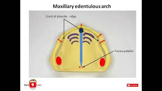 Anatomical landmarks in maxillary edentulous arch [upl. by Marina]