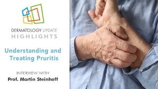 Understanding and Treating Pruritus  Dermatology Update 2016 [upl. by Nayr]