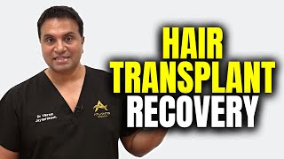 What To Expect After A Hair Transplant [upl. by Nirahs]