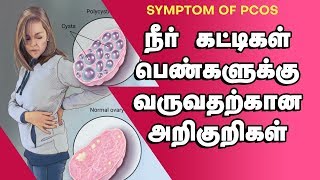 Dr G Buvaneswari  Fertility Specialist  PCOS In tamil  நீர்கட்டிகள் அறிகுறிகள் மற்றும் காரணங்கள் [upl. by Yttap585]