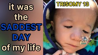 Trisomy 13 The day my son stopped smiling  Trisomy 13 amp 18  13トリソミー [upl. by Rolecnahc828]