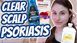 How to CLEAR SCALP PSORIASIS Dr Dray [upl. by Felice]