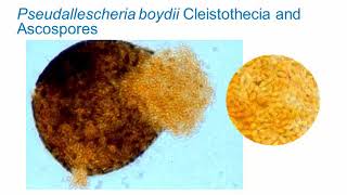 Identification of Melanized Dermatitiaceous Fungi Part 3 Hot Topic [upl. by Graner]