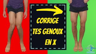 genou en x ou valgus  exercice kiné pour le corriger [upl. by Giule]