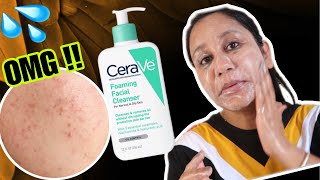 Cerave Foaming Cleanser For Oily Acne Prone Skin [upl. by Grimonia]