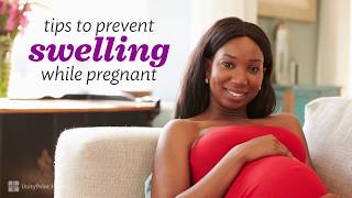 Things That Make You Swell When You’re Pregnant [upl. by Adebayo]