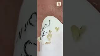 Blackheads Removal  Acne Treatment and Very Satisfying Satisfying Pimple pop blackheads [upl. by Marcell]