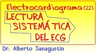 Electrocardiograma 22 LECTURA del ECGEKG e interpretación [upl. by Nixie]