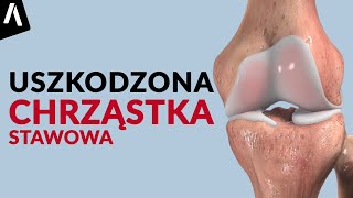 Uszkodzona chrząstka stawowa a choroba zwyrodnieniowa stawów [upl. by Googins]