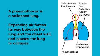 Lung Overexpansion Injuries [upl. by Beghtol908]