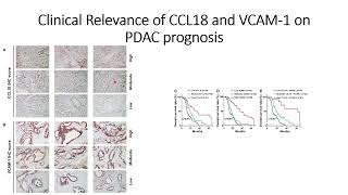 Clinical Relevance of VCAM1 and CCL18 on Pancreatic Cancer PDAC prognosis Code 671 [upl. by Eolanda]