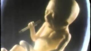 American Cancer Society  Smoking Fetus 1985 USA [upl. by Icyaj]