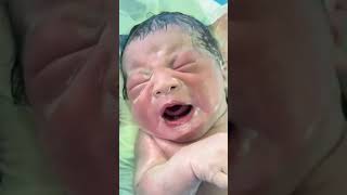 This newborn has a lot of amniotic fluid on his body and the nurse helps to wipe his body [upl. by Ajssatsan]