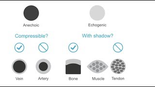 Distinguishing nerves from surrounding structures [upl. by Bald]