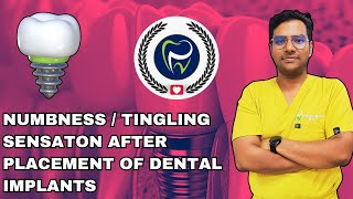 Dr Rudra Mohan  Neurosensory Disturbances After Dental Implant Placement  Numblness  Tingling [upl. by Ainalem340]