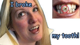 I broke my tooth [upl. by Odell]