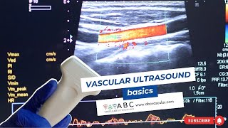 Vascular ultrasound basics [upl. by Pontius]