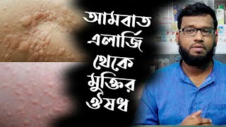 আমবাত চর্ম এলার্জির হোমিওপ্যাথি ঔষধ  urticaria hives homeopathy medicine [upl. by Alaham979]