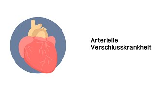 Arterielle Verschlusskrankheit AVK  Erkrankungen der Gefäße und des Kreislauf [upl. by Ahsii]