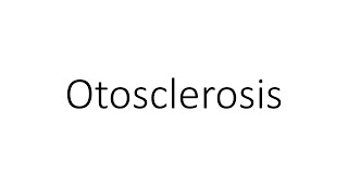 Otosclerosis  Quick Revision  ENT [upl. by Ahsok]