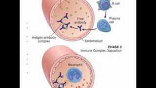 Systemic Lupus Erythrematosus SLE [upl. by Filomena]